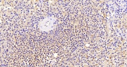 Thrombospondin 1 Polyclonal Antibody:Antibodies, Polyclonal