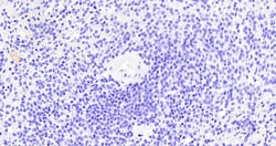 Thrombospondin 1 Polyclonal Antibody:Antibodies, Polyclonal