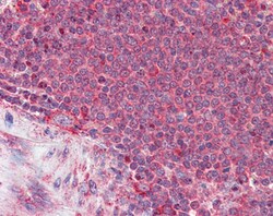 Thrombospondin 1 Polyclonal Antibody:Antibodies, Polyclonal
