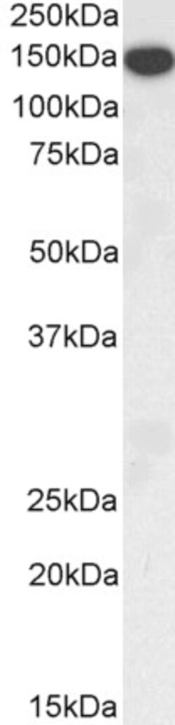 Thrombospondin 1 Polyclonal Antibody:Antibodies, Polyclonal