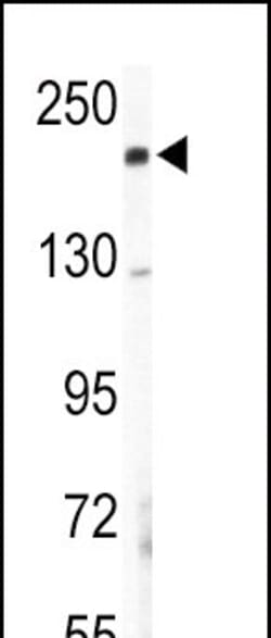 Invitrogen COL5A2 Polyclonal Antibody 400 &mu;L; Unconjugated:Antibodies,