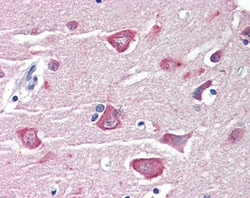 Invitrogen RASSF1 Polyclonal Antibody 100 μg; Unconjugated:Antibodies,