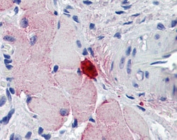 MCPT4 Polyclonal Antibody:Antibodies, Polyclonal