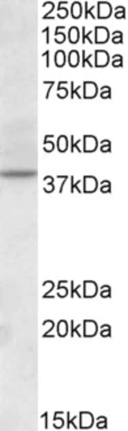 CDK10 Polyclonal Antibody:Antibodies, Polyclonal
