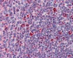 Invitrogen TYROBP Polyclonal Antibody 100 &mu;g; Unconjugated:Antibodies,