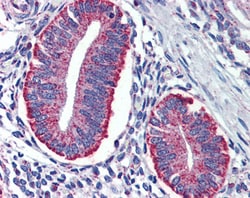 Invitrogen TYROBP Polyclonal Antibody 100 &mu;g; Unconjugated:Antibodies,