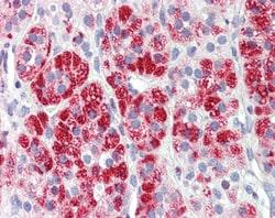 Invitrogen Clathrin Heavy Chain Polyclonal Antibody 100 &mu;g; Unconjugated:Antibodies,