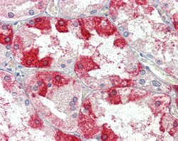 Invitrogen Clathrin Heavy Chain Polyclonal Antibody 100 &mu;g; Unconjugated:Antibodies,
