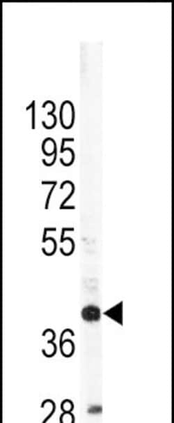 Invitrogen Apolipoprotein L1 Polyclonal Antibody 400 &mu;L | Buy Online | Invitrogen&trade; | Fisher Scientific