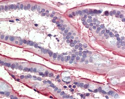 Invitrogen SGLT1 Polyclonal Antibody 100 &mu;g; Unconjugated:Antibodies,