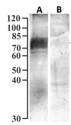 Invitrogen SGLT1 Polyclonal Antibody 100 &mu;g; Unconjugated:Antibodies,