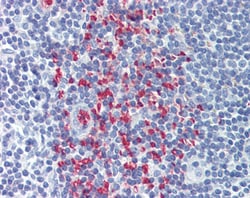 CLEC2D Polyclonal Antibody:Antibodies, Polyclonal