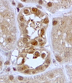 Invitrogen SGK1 Polyclonal Antibody 100 &mu;g; Unconjugated:Antibodies,