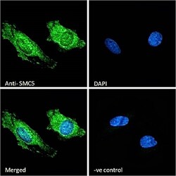 Invitrogen SMC5 Polyclonal Antibody 100 &mu;g; Unconjugated:Antibodies,