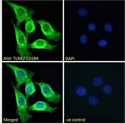 Invitrogen TLR4 Polyclonal Antibody 100 &mu;g; Unconjugated:Antibodies,