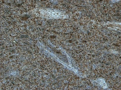 Invitrogen TLR4 Polyclonal Antibody 100 &mu;g; Unconjugated:Antibodies,