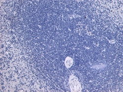 Invitrogen TLR4 Polyclonal Antibody 100 &mu;g; Unconjugated:Antibodies,