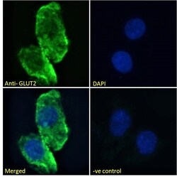 Invitrogen GLUT2 Polyclonal Antibody 100 μg; Unconjugated:Antibodies,