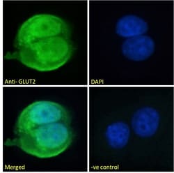 Invitrogen GLUT2 Polyclonal Antibody 100 μg; Unconjugated:Antibodies,
