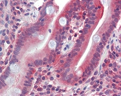 Invitrogen GLUT5 Polyclonal Antibody 100 &mu;g; Unconjugated:Antibodies,