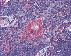 Invitrogen ICOS (CD278) Polyclonal Antibody 100 &mu;g; Unconjugated:Antibodies,