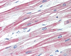Invitrogen EPM2AIP1 Polyclonal Antibody 100 &mu;g; Unconjugated:Antibodies,