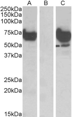 Invitrogen EPM2AIP1 Polyclonal Antibody 100 &mu;g; Unconjugated:Antibodies,