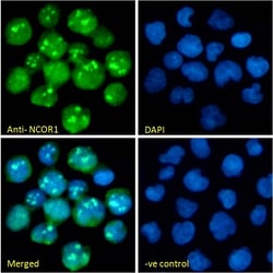 Invitrogen NCoR1 Polyclonal Antibody 100 &mu;g; Unconjugated:Antibodies,