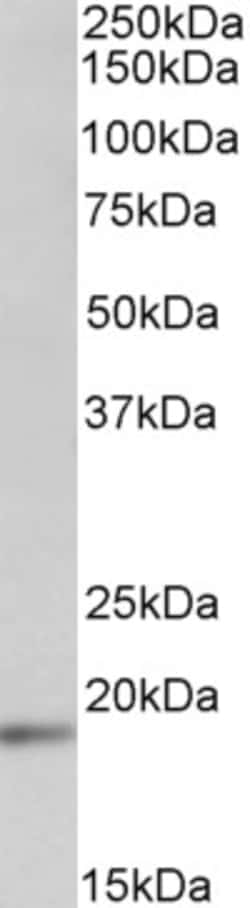 Invitrogen UBE2C Polyclonal Antibody 100 &mu;g; Unconjugated:Antibodies,