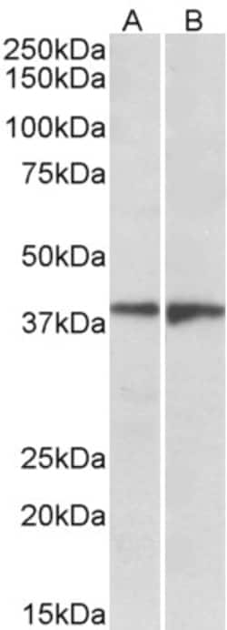 Invitrogen EDG8 Polyclonal Antibody 100 μg; Unconjugated:Antibodies,