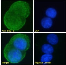 Invitrogen PDGF-B Polyclonal Antibody 100 &mu;g; Unconjugated:Antibodies,