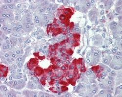 Invitrogen PDGF-B Polyclonal Antibody 100 &mu;g; Unconjugated:Antibodies,