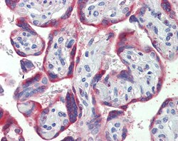 Invitrogen PDGF-B Polyclonal Antibody 100 &mu;g; Unconjugated:Antibodies,