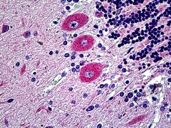 Invitrogen EphB6 Polyclonal Antibody 100 μg; Unconjugated:Antibodies,