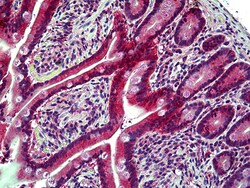 Invitrogen EphB6 Polyclonal Antibody 100 μg; Unconjugated:Antibodies,