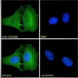 Invitrogen COL4A6 Polyclonal Antibody 100 &mu;g; Unconjugated:Antibodies,