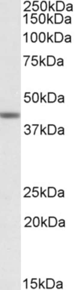 TAF7L Polyclonal Antibody:Antibodies, Polyclonal