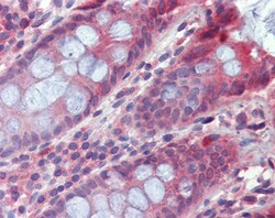 Invitrogen TPCN2 Polyclonal Antibody 100 &mu;g; Unconjugated:Antibodies,