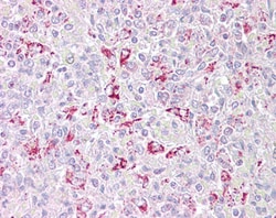 Invitrogen PFKFB2 Polyclonal Antibody 100 &mu;g; Unconjugated:Antibodies,