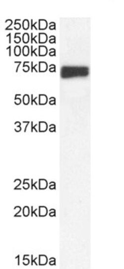 Invitrogen MNT Polyclonal Antibody 100 &mu;g | Buy Online | Invitrogen&trade; | Fisher Scientific