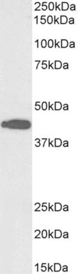 Invitrogen ACAT1 Polyclonal Antibody, Biotin 100 &mu;g; Biotin:Antibodies,