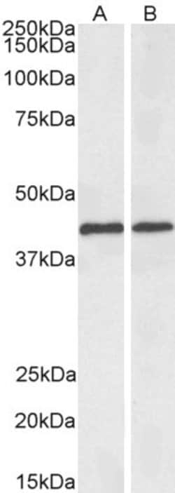 ACAT1 Polyclonal Antibody, Biotin:Antibodies, Polyclonal