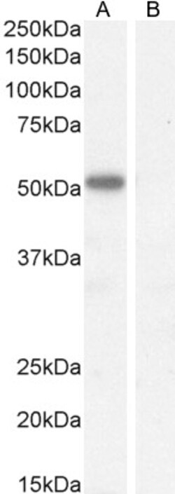 Invitrogen IKZF4 Polyclonal Antibody 100 &mu;g; Unconjugated:Antibodies,