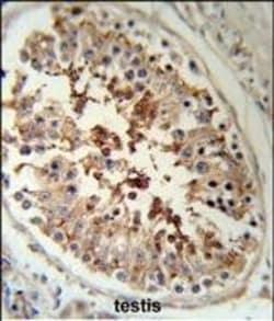 Invitrogen SERPINH1 Polyclonal Antibody 400 μL; Unconjugated:Antibodies,