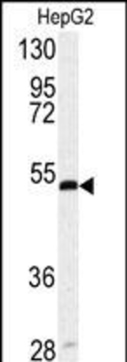Invitrogen SERPINH1 Polyclonal Antibody 400 μL; Unconjugated:Antibodies,