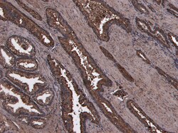 Invitrogen HOXD13 Polyclonal Antibody 100 μg; Unconjugated:Antibodies,