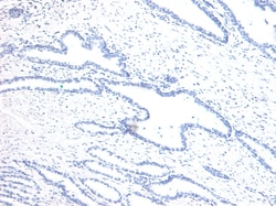 Invitrogen HOXD13 Polyclonal Antibody 100 μg; Unconjugated:Antibodies,
