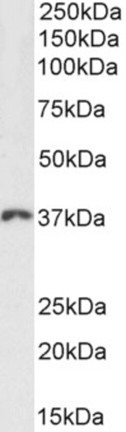 Invitrogen HOXD13 Polyclonal Antibody 100 μg; Unconjugated:Antibodies,