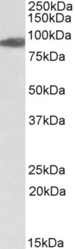 Invitrogen Aconitase 2 Polyclonal Antibody, Biotin 100 &mu;g; Biotin:Antibodies,