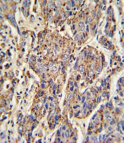 Invitrogen Cathepsin B Polyclonal Antibody 400 μL; Unconjugated:Antibodies,